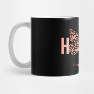 Hope For A Cure Butterfly Gift Uterine cancer 2 Mug